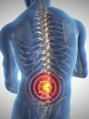 The Back Pain Breakthrough – #1 Doctor Approved Solution